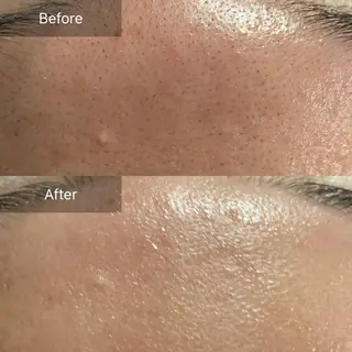 Mandarin Orange所属・毛穴から始める肌メン テマンダリンオレンジのエステ・リラクイメージ