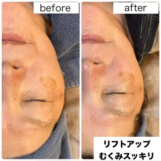 leolo武蔵浦和 肌質改善&脱毛のエステ・リラクイメージ