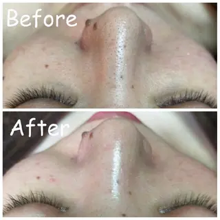 小顔艶肌＆痩身サロン 🍋 Meguのエステ・リラクイメージ