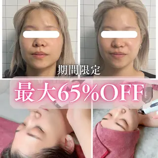 小顔矯正専門店 【RED】池田のエステ・リラクイメージ