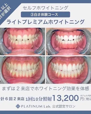 カラー メンズ キッズ ネイル マツエク・マツパ アイブロウ プラチナムビューティー柏所属・【歯科提携】柏ホワイ トニングスタイルのその他イメージ