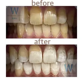 ホワイトニング ショップ船橋店のエステ・リラクイメージ