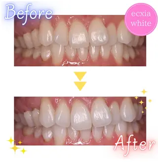 ecxia  white 　広島袋町店所属・セルフホワイトニング エクシア広島袋町店のその他イメージ