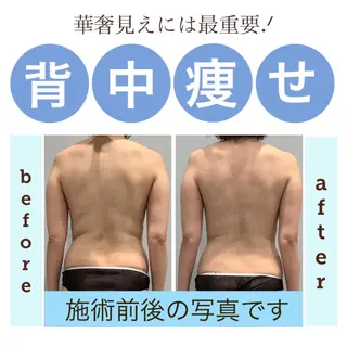 エステサロン JURISのエステ・リラクイメージ