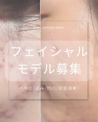 田中For..天王寺 肌質改善/よもぎ蒸しのエステ・リラクイメージ