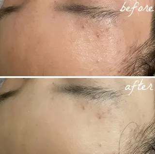 メンズ メナード岐阜茜部 杉浦のエステ・リラクイメージ