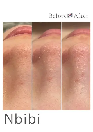 韓国🇰🇷価格 サロン_Nbibiのエステ・リラクイメージ