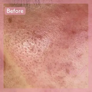 毛穴ケア専門サロン miliのエステ・リラクイメージ