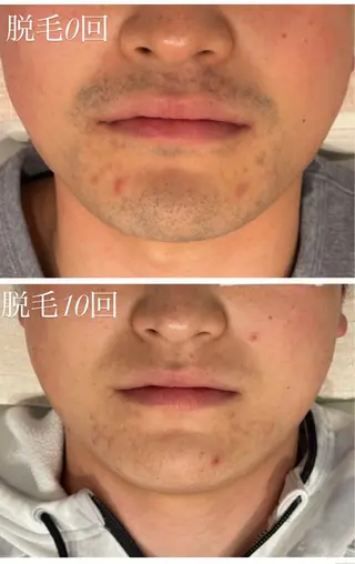 TotalBeautySalon UNCHEL所属・Ito ayakaのその他イメージ