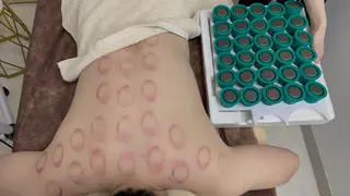 ニキビ、痩身、脱毛、 サクラチャンスパのエステ・リラクイメージ