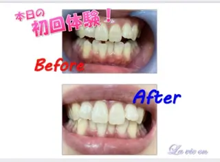 セルフホワイトニングサロン　ラヴィアン所属・ホワイトニングサロン La vie enのその他イメージ