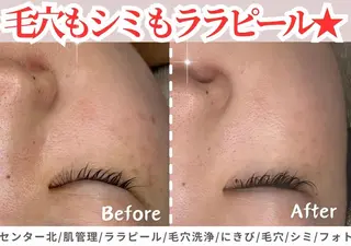 sii センター北 AIのエステ・リラクイメージ