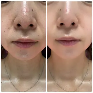 salon.de.STAR  ・デアイム王寺所属・末永 美沙紀のその他イメージ