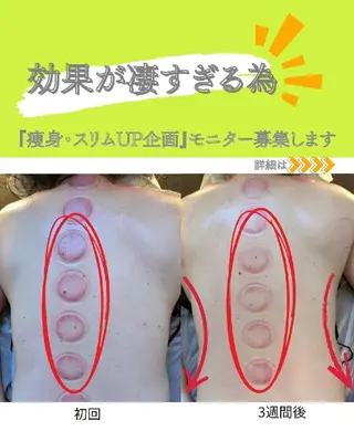 カッサ・カッピング専門サロン 水玉屋−suidamaya−所属・カッサ・カッピング 専門サロン/水玉屋のエステ・リラクイメージ