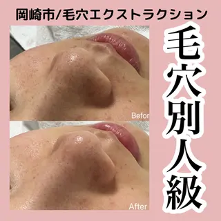 ■超絶小顔＆肌管理室■所属・🦋整形級の究極美顔 本格韓国式小顔🦋のエステ・リラクイメージ
