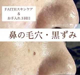 都度払い 肌質改善専門サロンのエステ・リラクイメージ