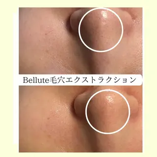 ピーリング専門店 Belluteのエステ・リラクイメージ