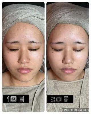 エステ✖️ネイル Feelのネイルデザイン