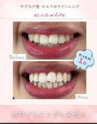 エクシアホワイト 立川南口のエステ・リラクイメージ