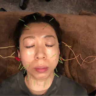 美容鍼灸サロン LOMIHARIのエステ・リラクイメージ