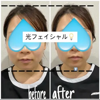 毛穴洗浄・痩身・脱毛 /アルカンジュのエステ・リラクイメージ