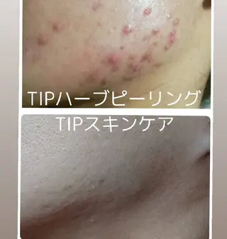 Salon b.p. 渋谷所属・渋谷   Salon b.pのエステ・リラクイメージ