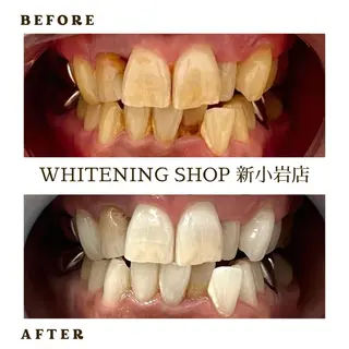 メンズ ホワイトニング ショップ新小岩店のその他イメージ