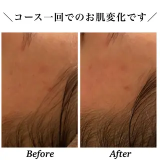 Bellesthe (ベルエステ)のエステ・リラクイメージ