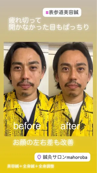 美容鍼灸サロン mahoroba院長のエステ・リラクイメージ