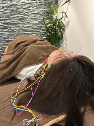 美容鍼灸整体サロンBeauJu所属・小顔矯/美容鍼/鍼灸 BeauJuのその他イメージ