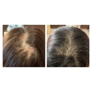 きよもと鍼灸院所属・きよもと鍼灸院 清本義明のその他イメージ