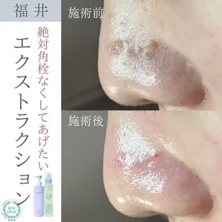 毛穴ケア専門サロン Yourmeユアミーのエステ・リラクイメージ