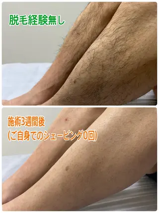 メンズ 駅前脱毛Oli🌿‬ 美肌脱毛♡小顔のエステ・リラクイメージ