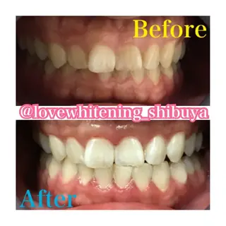 LOVE ホワイトニング渋谷のその他イメージ