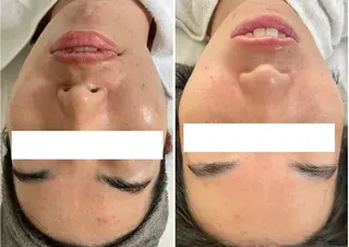 Miroire所属・Miroire ミロワールのエステ・リラクイメージ