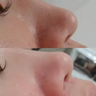 Anacia Beauty Salon所属・美肌脱毛&毛穴専門 Anaciaのエステ・リラクイメージ