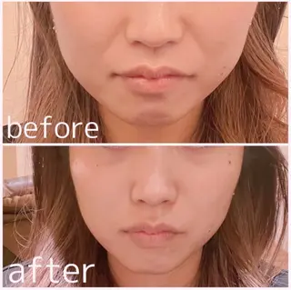 MORE BEAUTY ESTHE 本通り店所属・more 𓍯 のエステ・リラクイメージ