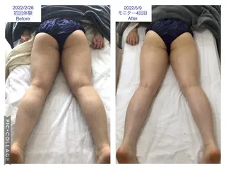 子宮矯正/腸揉み/ シュガーリング脱毛のエステ・リラクイメージ