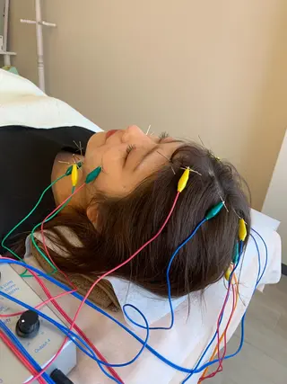 新宿hari-me所属・美容鍼hari-me 新宿のエステ・リラクイメージ