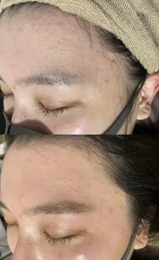 アイブロウ メンズ キッズ Epina 千葉店 【エピナ】のエステ・リラクイメージ