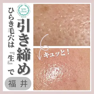 毛穴ケア専門サロン Yourmeユアミーのエステ・リラクイメージ