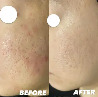 ショート カラー パーマ ヘアアレンジ メンズ キッズ ネイル マツエク・マツパ アイブロウ NANI OAFU所属・NANIOAFU [なんば店］のその他イメージ