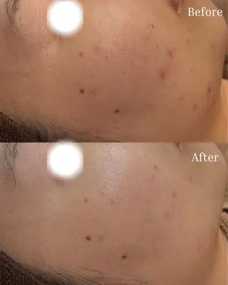 BELLIS HUIT所属・肌質改善｜体質改善ꕤ BELLISHUITのエステ・リラクイメージ