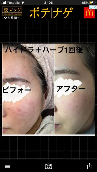 ロング カラー パーマ ヘアアレンジ メンズ キッズ ネイル マツエク・マツパ アイブロウ ハーブピーリング専門 🌿モッカのエステ・リラクイメージ