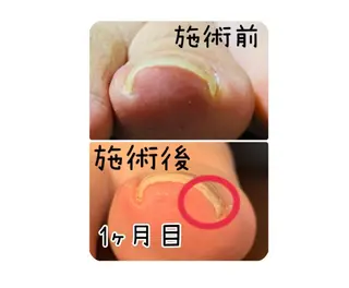 ネイル Nailsalon Spina 琴美のネイルデザイン