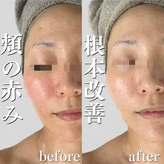 Daria所属・Daria 山本知未のエステ・リラクイメージ