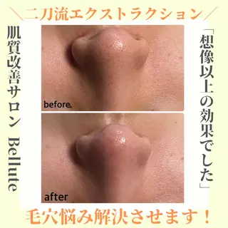 ピーリング専門店 Belluteのエステ・リラクイメージ