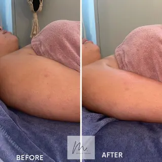 SHARES MADOKAのエステ・リラクイメージ