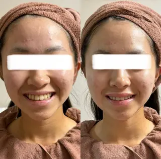 透明感の肌Lino malieのエステ・リラクイメージ