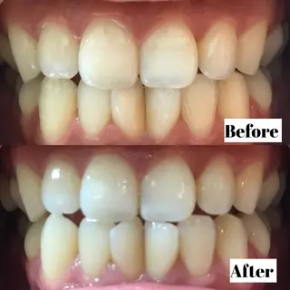 LBS吉祥寺 公式のエステ・リラクイメージ